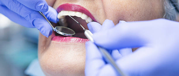 Best Emergency Dental Extractions in Lincoln Park, NY